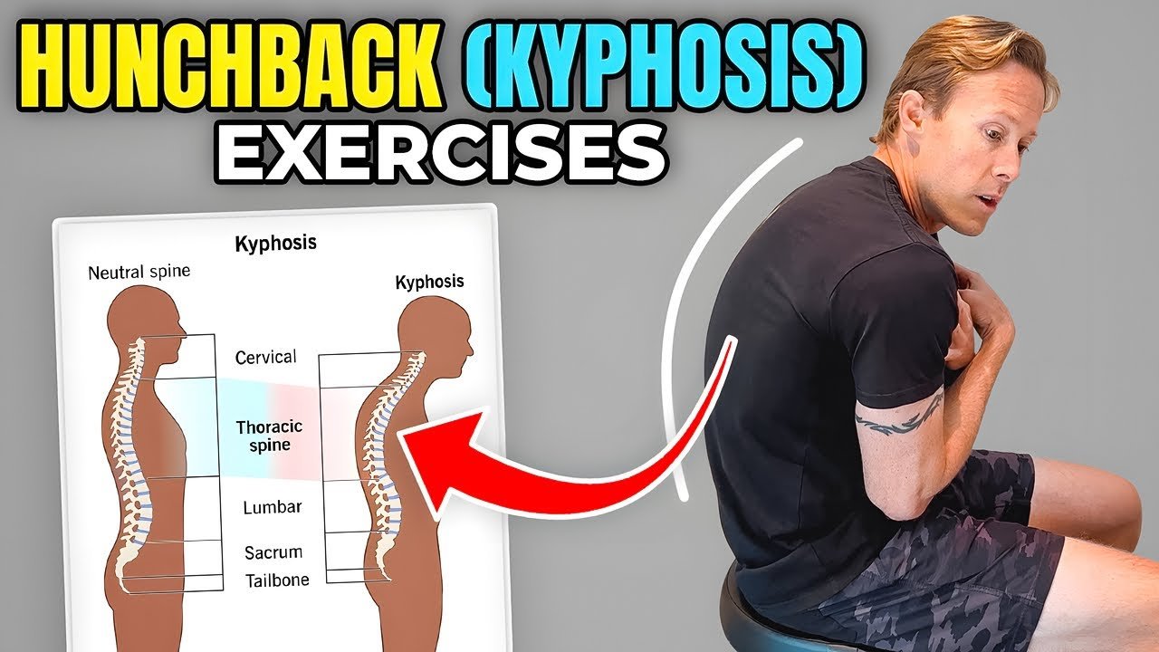 https://www.can physical therapy correct hunch back​